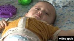 A child being treated for a birth defect at a hospital in Tajikistan's Khatlon region.