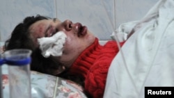 Ukrainian journalist and activist Tetyana Chornovol lies on a stretcher at a hospital in Kyiv on Christmas Day. 