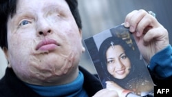 Ameneh Bahrami, in Barcelona for one of more than a dozen operations since the attack, holds a photograph of herself before Majid Movahedi dumped a bucket of acid on her outside her workplace in 2004.